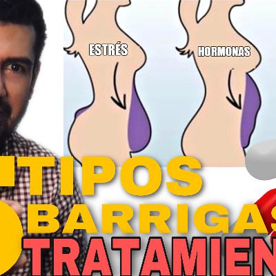 Epi 02/ Los 5 tipos de Barrigas y cómo Eliminarlas