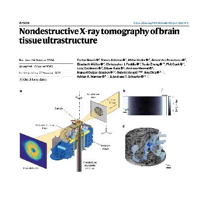 317-X-ray Nanotomography of Intact Neural Tissue 317-X-ray Nanotomography of Intact Neural Tissue