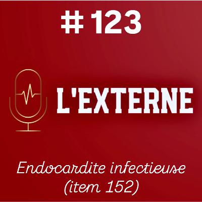 Episode 123 - Endocardite infectieuse (item 152) Episode 123 - Endocardite infectieuse (item 152)