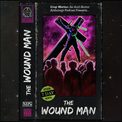 40 - The Wound Man