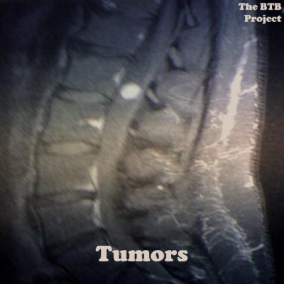 Overcoming Adversity: The BTB Project's Journey with Spinal Tumors and Triumph