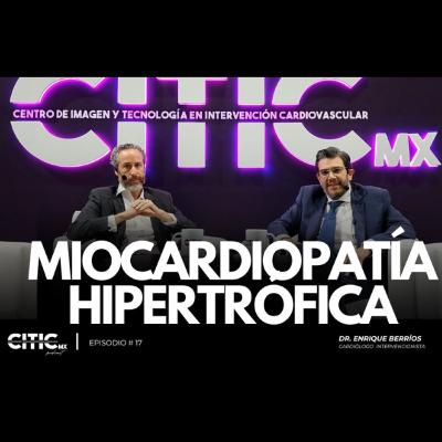 Miocardiopatía Hipertrófica Miocardiopatía Hipertrófica