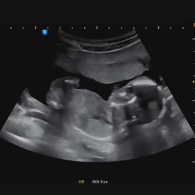Womb ASMR with Shhh Sound Womb ASMR with Shhh Sound