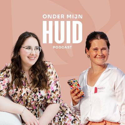 OMH #7. Annelies Breine over leven met psoriasis en de moed om zichtbaar te zijn OMH #7. Annelies Breine over leven met psoriasis en de moed om zichtbaar te zijn