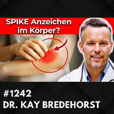 Histaminintoleranz: Nahrung ist NICHT das Problem | Dr. Kay Bredehorst #1242