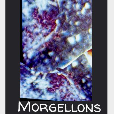 Lost to Morgellons