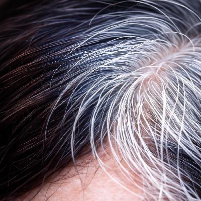 Las canas podrían estar salvando tu vida