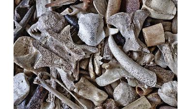 Osteosarcoma with Dr. Katherine Janeway Osteosarcoma with Dr. Katherine Janeway