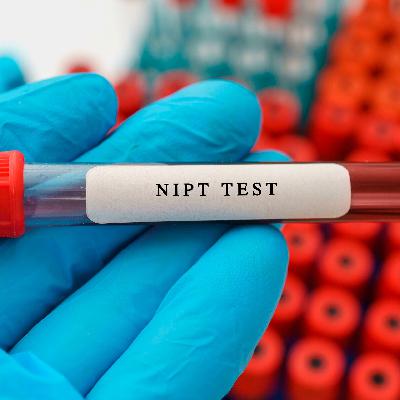 Diskussion um Pränataltest – Wann ist ein NIPT sinnvoll? Diskussion um Pränataltest – Wann ist ein NIPT sinnvoll?