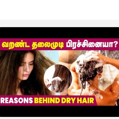 Reason for Dry Hair | How to fix Dry Hair? | Hair Care Tamil Reason for Dry Hair | How to fix Dry Hair? | Hair Care Tamil
