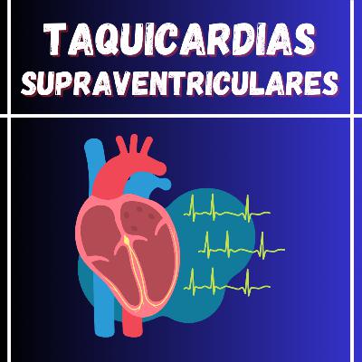 Capítulo 163: Taquicardias Supraventriculares