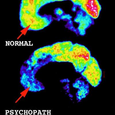 Ep. 23 Jim Fallon and the Psychopaths, Part 1
