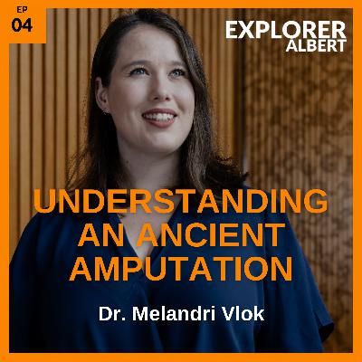 Understanding An Ancient Amputation with Dr. Melandri Vlok