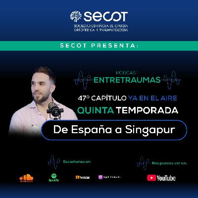 De España a Singapur