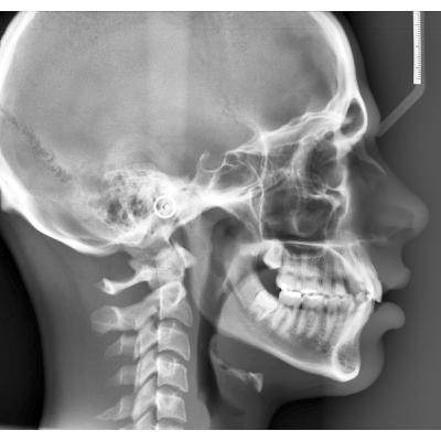 caso clínico ortodoncia