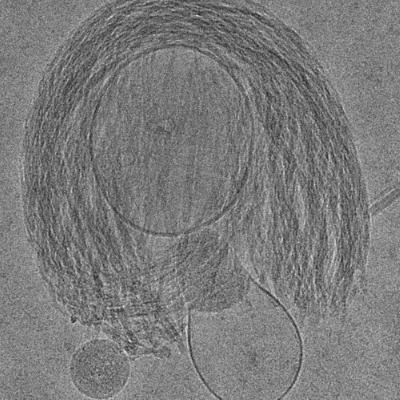 #42 – Matic Kisovec: Krioelektronska mikroskopija #42 – Matic Kisovec: Krioelektronska mikroskopija