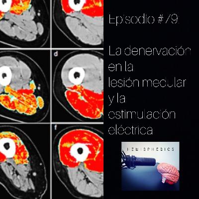 #79: La denervación en la lesión medular y la estimulación eléctrica