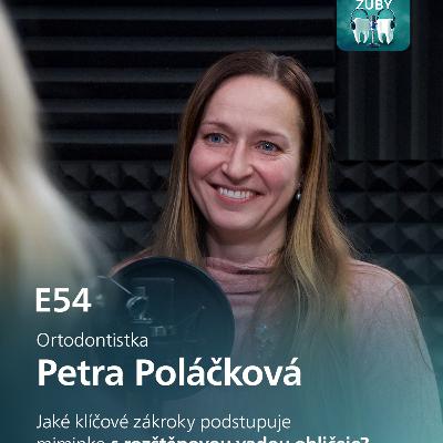 E54: Rozštěpové vady obličeje s Petrou Poláčkovou