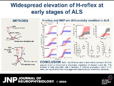 H-Reflex as a Biomarker: Insights from ALS Research