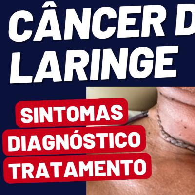 Câncer de Laringe: Como Reconhecer os Sintomas e Garantir o Tratamento Correto Câncer de Laringe: Como Reconhecer os Sintomas e Garantir o Tratamento Correto