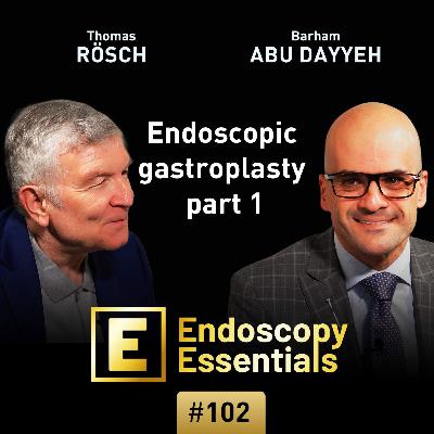 Endoscopic gastroplasty part 1: Background and indication Endoscopic gastroplasty part 1: Background and indication