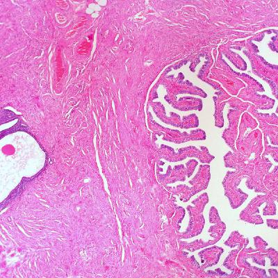 Bonus Interview: Libby Hopton on the Origins of Endometriosis