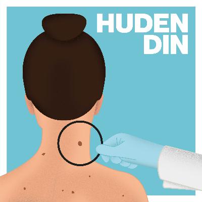 Føflekker og hudkreft