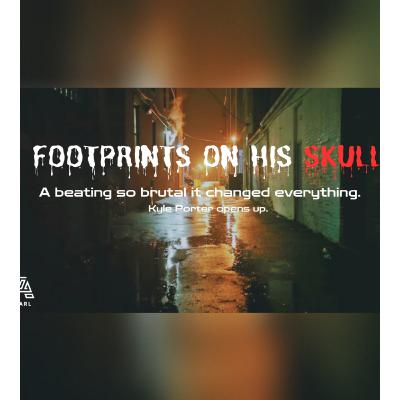 He Woke Up With Footprints on His Head: The Brutal Attack That Changed Kyle Porters Life