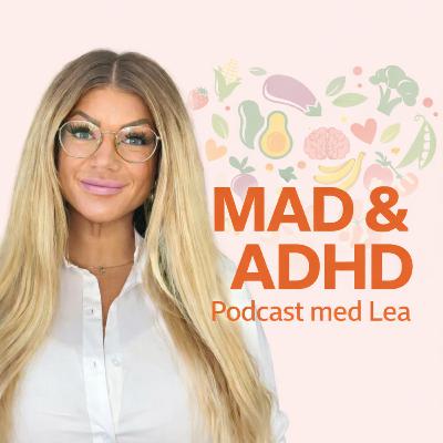 Mad og ADHD #1: Hvorfor ADHD gør mad sværere