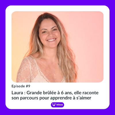 #9 - LAURA : GRANDE BRULEE A 6 ANS, ELLE RACONTE SON PARCOURS POUR APPRENDRE A S’AIMER #9 - LAURA : GRANDE BRULEE A 6 ANS, ELLE RACONTE SON PARCOURS POUR APPRENDRE A S’AIMER