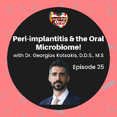 Peri-Implantitis & the Oral Microbiome with Dr. Georgios Kotsakis! Peri-Implantitis & the Oral Microbiome with Dr. Georgios Kotsakis!