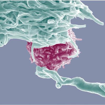 b-cell development ( Immunology part 10