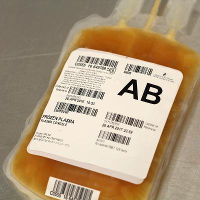 What is Plasma Therapy? What is Plasma Therapy?