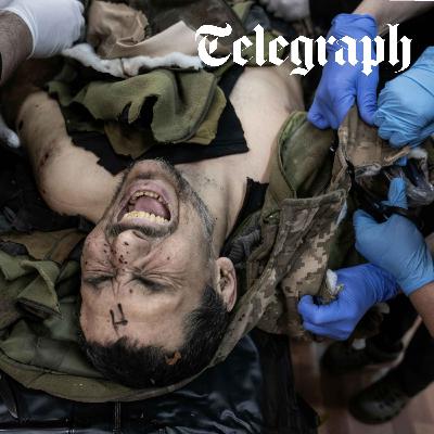 Why Ukraine's troops are facing an amputation crisis