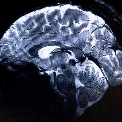 When is your brain actually an "adult"? When is your brain actually an "adult"?