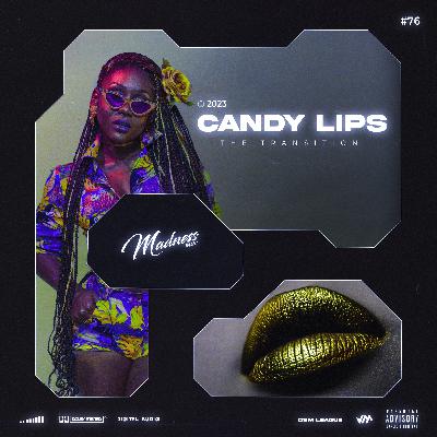 Candy Lips 76 The Transition