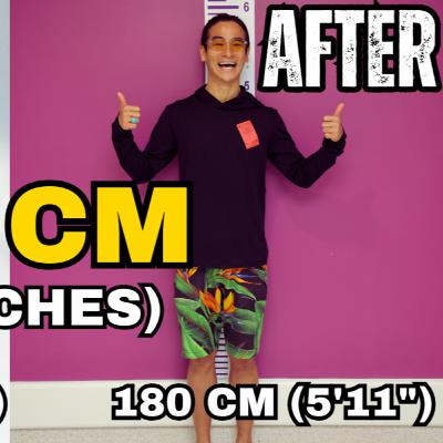 He Added 4 Inches to His Height: Ryo's Limb Lengthening Journey (170cm → 180cm)