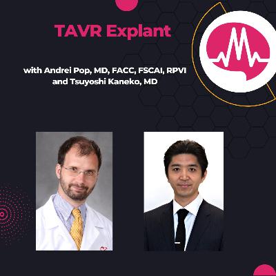 TAVR Explant: Why Mortality Is Dropping & How Surgeons Are Changing the Game featuring Dr. Kaneko and Dr. Pop