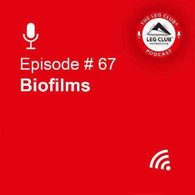 Biofilms