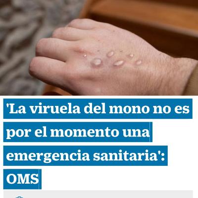 "VIRUELA DEL MONO SEGÚN LA OMS" Voz Nadine Viana. Junio 30 2022. Barranquilla - Colombia.