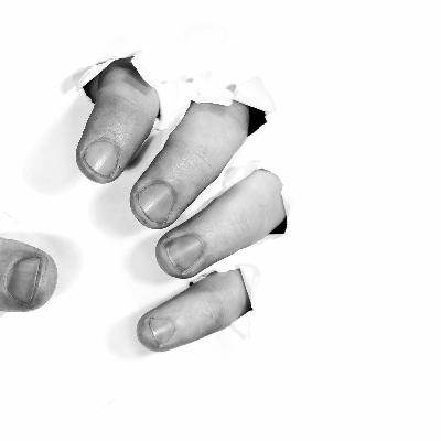 Reasons for Catching Nail Fungus