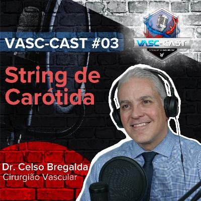 VASC-Cast #3: String de Carótida com Dr. Celso Bregalda