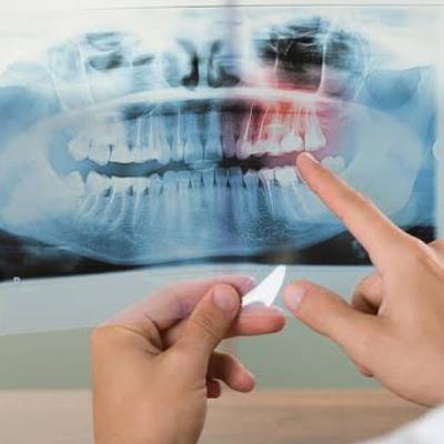 Los Rayos X en odontología