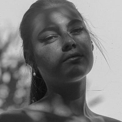 Holiday Melasma Holiday Melasma