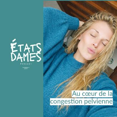Au cœur de l’endométriose… à la congestion pelvienne Au cœur de l’endométriose… à la congestion pelvienne