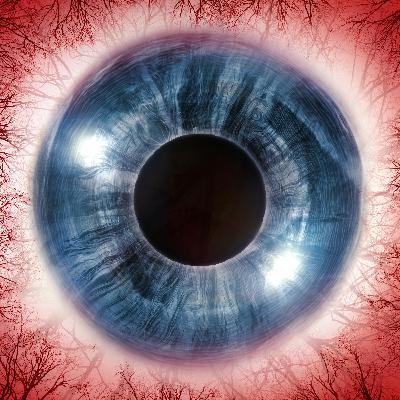 Ocular Injuries Ocular Injuries