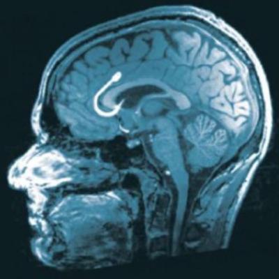 3.2 continuación de sugerencias 3.2 continuación de sugerencias