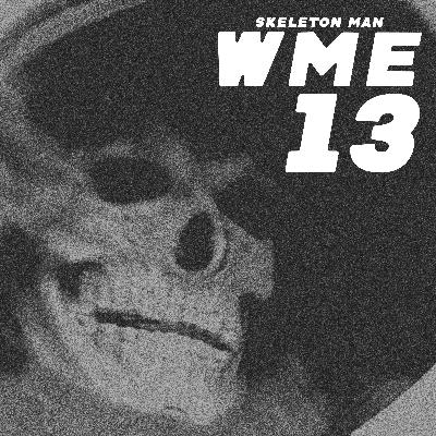 13 - Skeleton Man