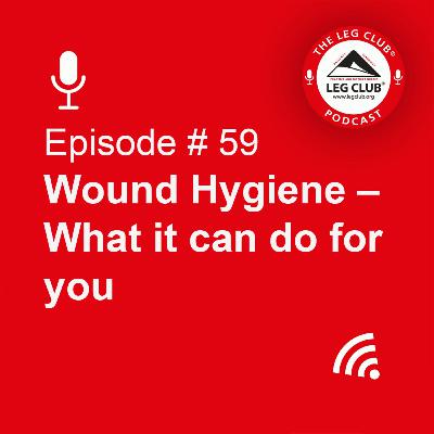 Wound Hygiene – What can it do for you