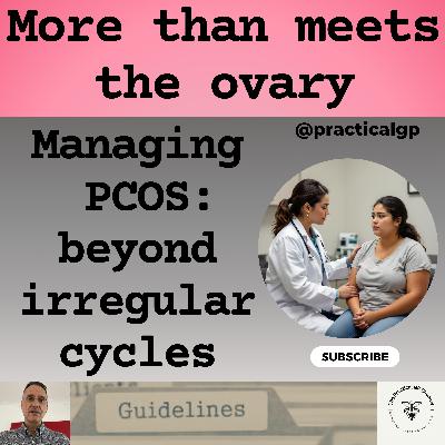 Podcast - Managing PCOS: Beyond irregular cycles